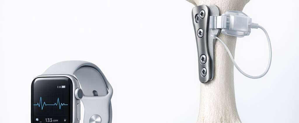 The Accuracy Gap: Validating consumer wearables for clinical use.
