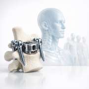 1b65fd70-in-silico-trials-can-we-test-implants-on-virtual-populations.png In silico Trials: Can we test implants on virtual populations?